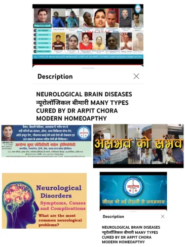 NEUROLOGICAL BRAIN DISEASES  Treatment  service image