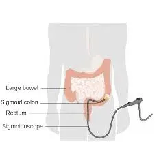 SIGMOIDOSCOPY service image