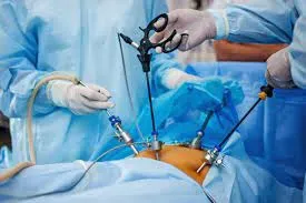 LAPAROSCOPIC SURGERIES service image