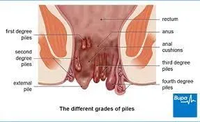 PILES service image