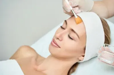 Chemical Peel service image