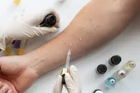 Allergy Testing service image
