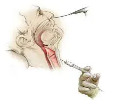 Cosmetic Voice Surgery (Injection) service image