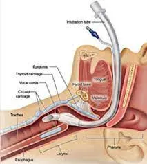 Cosmetic Voice Surgery (Classical) service image