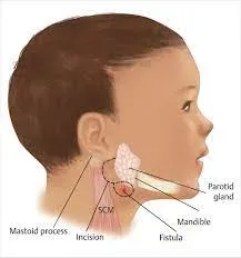 Branchial Sinus service image