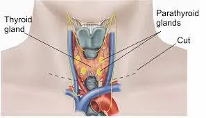 Thyroidectomy service image