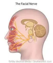 Facial Nerve Decompression service image