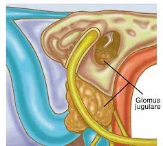 Surgery For Glomus Tympanicum And Jugulare service image