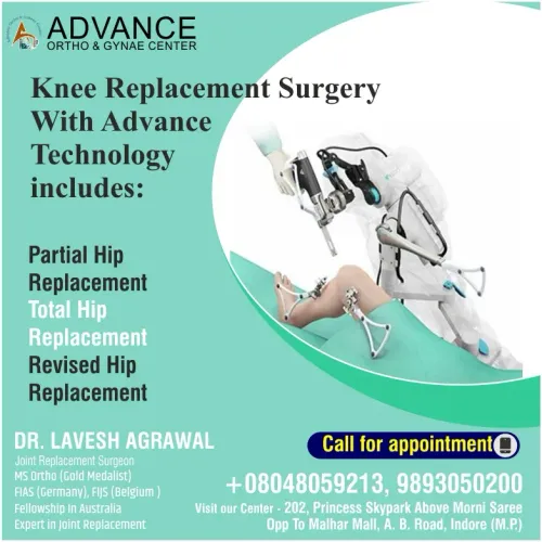 Knee replacement Treatment service image