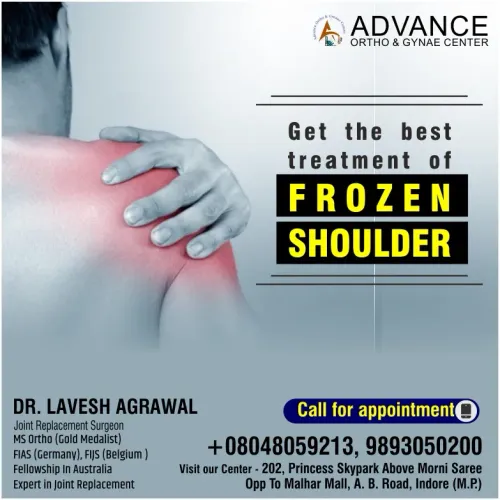 Frozen Shoulder Treatment service image
