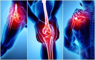Joint replacement treatment service image