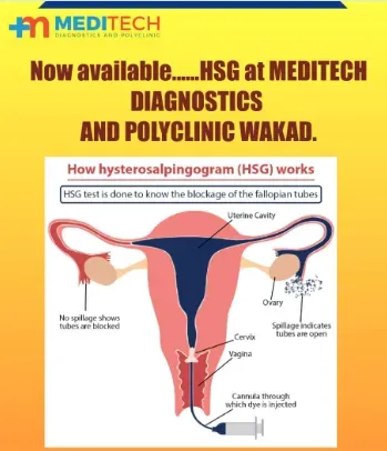 HYSTEROSALPINGOGRAPHY (HSG) CENTRE IN WAKAD,HINJEWADI,PCMC service image