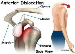 Shoulder Dislocation and Instability service image