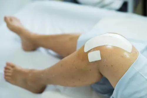 Knee Joint Preservation service image