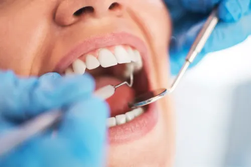 Oral Hygiene service image