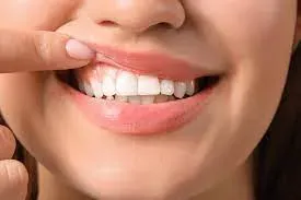 Gum Care service image
