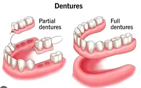 Denture service image