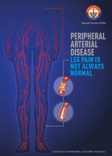 Peripheral Vascular disease service image