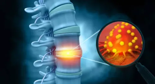 Bone Sarcoma, Benign Bone Tumor  service image
