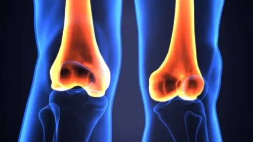 Bone Cyst service image