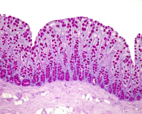 Soft Tissue Tumor service image