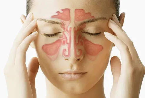 Sinusitis Treatment Clinic in Rahatani,Kalewadi,Pimple Saudagar,PCMC service image