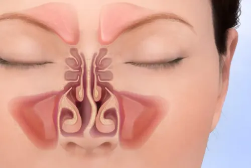 Septoplasty Clinic in Rahatani,Kalewadi,Pimple Saudagar,PCMC service image