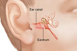 Tympanoplasty Clinic in Rahatani,Kalewadi,Pimple Saudagar,PCMC service image