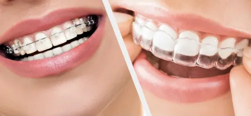 Orthodontic Treatment service image