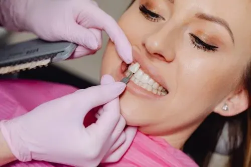 Cosmetic/ Aesthetic Dentistry service image