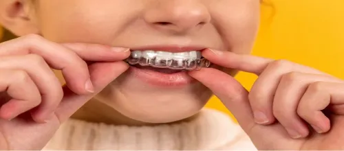 Mouth Guard service image