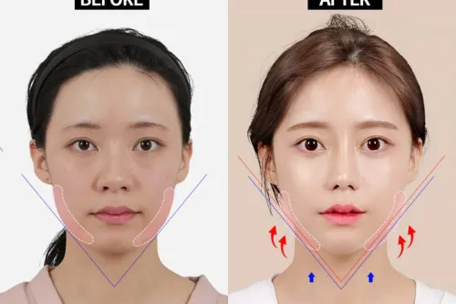 Brow And Forehead Lift service image