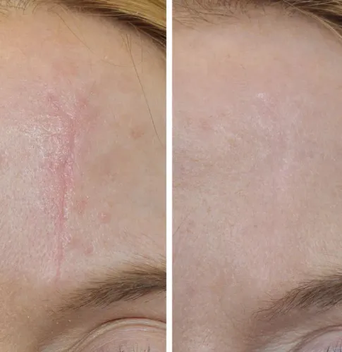 Scar Revision service image