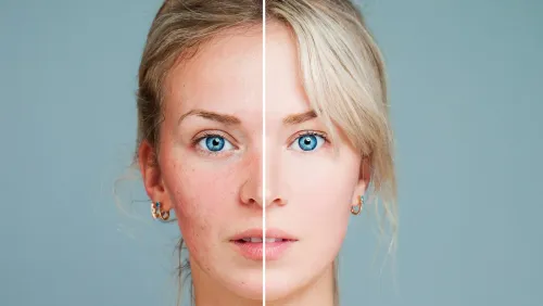 Facial Fillers service image