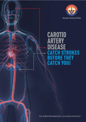 CAROTID ARTERY DISEASE service image