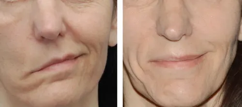 Facial Paralysis Surgery service image