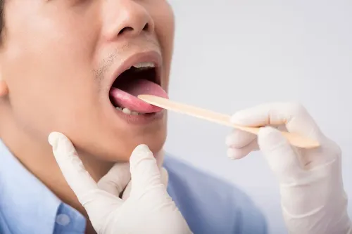 Tongue Tumor Surgery service image