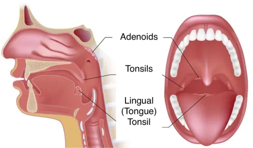 Tongue Reduction Surgery service image