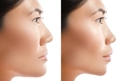 Jaw Alignment Surgery service image