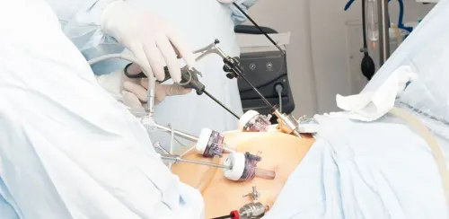 HYSTEROSCOPY AND LAPAROSCOPY service image