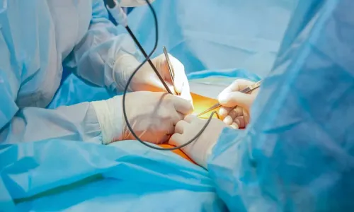 Gastro and Colorectal Surgery Laproscopic  service image