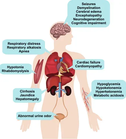 Inborn Errors of Metabolism service image