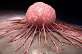 Paediatric Solid Tumors service image