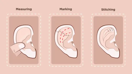 Prominent Ear Surgery service image