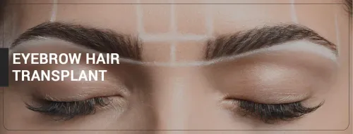 Eyebrow Transplantation service image