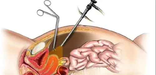 Laparoscopy and Hysteroscopy service image