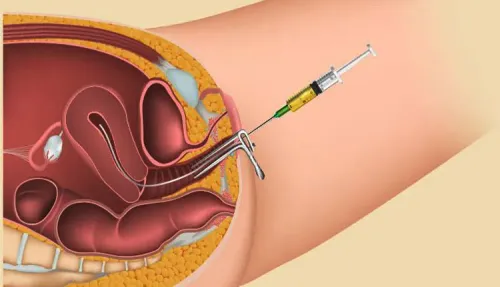 IUI (Intrauterine Insemination) service image