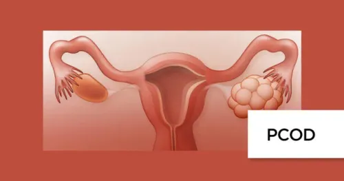 PCOD (Polycystic Ovary Syndrome) service image