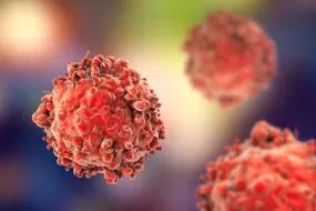 Leukemia and Lymphoma service image