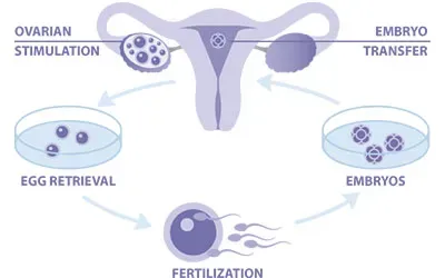 IVF: In-vitro Fertilization service image